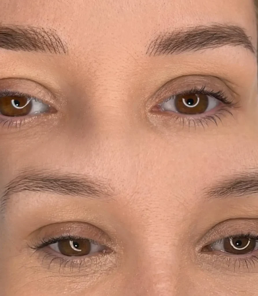 Antes y despues de micropigmentacion en cejas