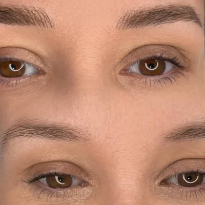 Antes y despues de micropigmentacion en cejas