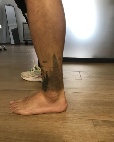 tatuajes de cover up en la pierna