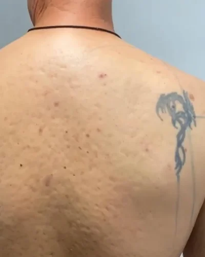cover up tattoo espalda